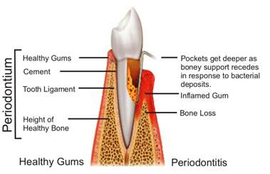 Healthy Teeth + Gums